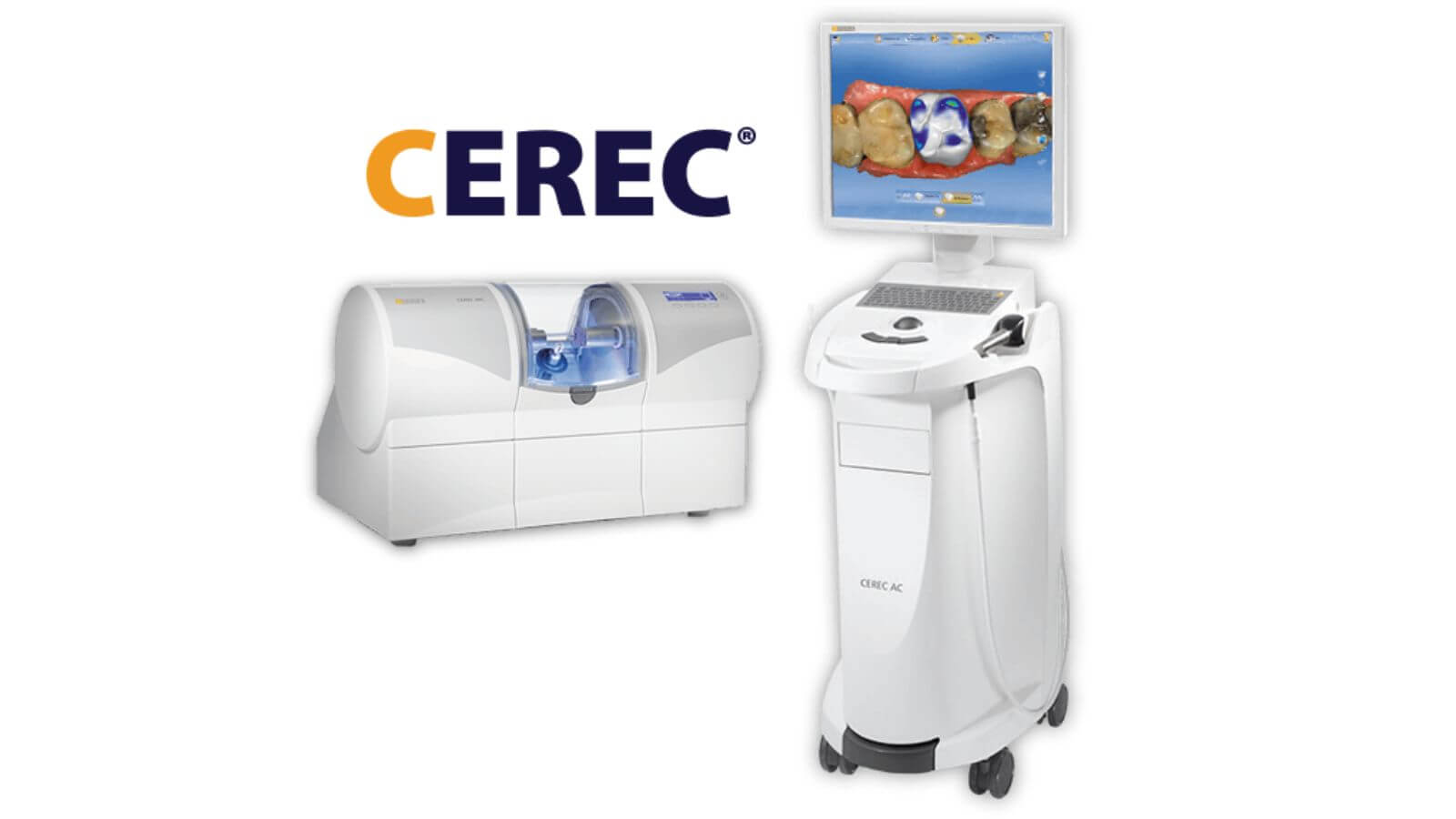 CEREC 